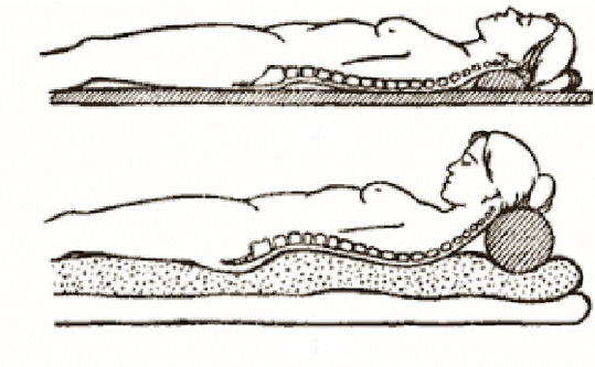 Figura da osteocondrose