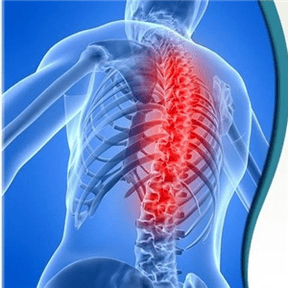 A osteocondrose das espincias pode ser causada por varias causas
